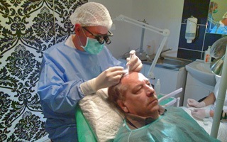 Haartransplantatie bij PHAEYDE Clinic Hongarije