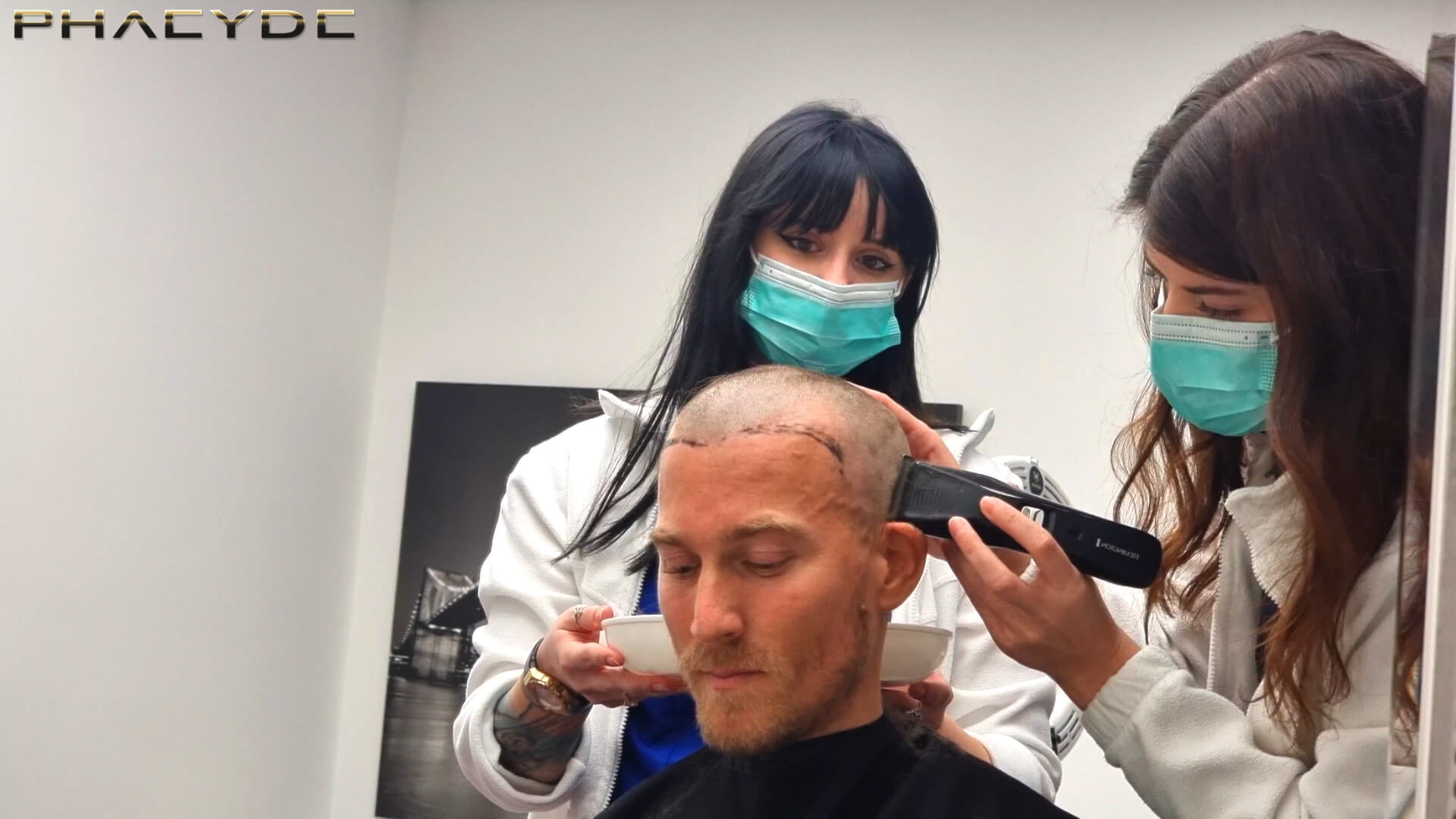 8+1 Myths About Hair Transplantation 8+1 Myths About Hair Transplantation