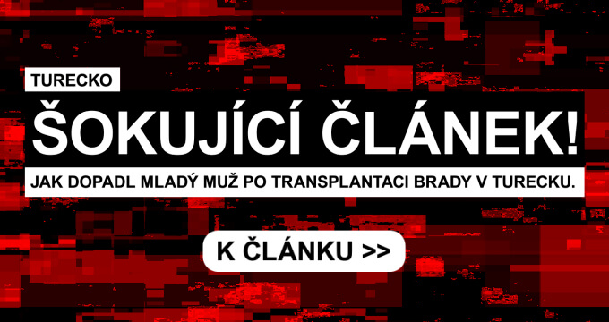 Hair transplant at the PHAEYDE clinic in Budapest