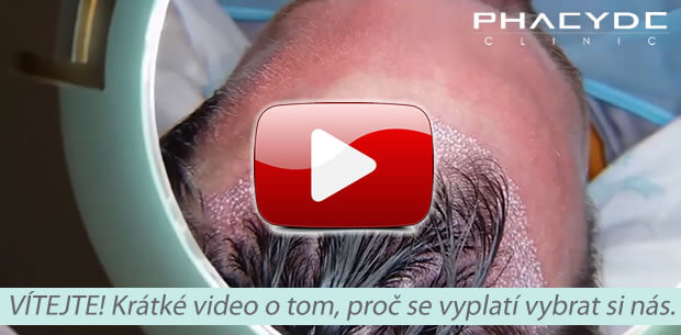  PHAEYDE Hair Transplantation Sale 